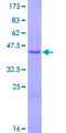 PLA2G12A Protein - 12.5% SDS-PAGE of human PLA2G12A stained with Coomassie Blue