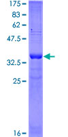PLA2G12A Protein - 12.5% SDS-PAGE Stained with Coomassie Blue.