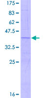 PLA2G12B Protein - 12.5% SDS-PAGE Stained with Coomassie Blue.
