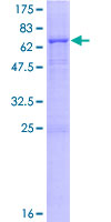 PLA2G15 / ACS Protein - 12.5% SDS-PAGE of human LYPLA3 stained with Coomassie Blue