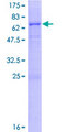 PLA2G15 / ACS Protein - 12.5% SDS-PAGE of human LYPLA3 stained with Coomassie Blue