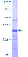 PLA2G15 / ACS Protein - 12.5% SDS-PAGE Stained with Coomassie Blue.