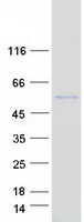 PLA2G15 / ACS Protein - Purified recombinant protein PLA2G15 was analyzed by SDS-PAGE gel and Coomassie Blue Staining