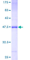 PLA2G16 / HRASLS3 Protein - 12.5% SDS-PAGE of human HRASLS3 stained with Coomassie Blue