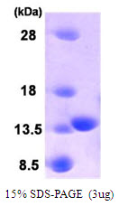 PLA2G16 / HRASLS3 Protein