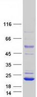 PLA2G16 / HRASLS3 Protein - Purified recombinant protein PLA2G16 was analyzed by SDS-PAGE gel and Coomassie Blue Staining