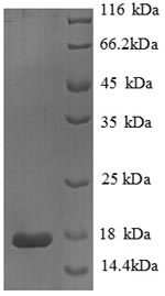 PLA2G2A / SPLA2 Protein - (Tris-Glycine gel) Discontinuous SDS-PAGE (reduced) with 5% enrichment gel and 15% separation gel.