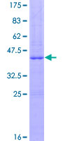 PLA2G2A / SPLA2 Protein - 12.5% SDS-PAGE of human PLA2G2A stained with Coomassie Blue