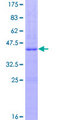 PLA2G2A / SPLA2 Protein - 12.5% SDS-PAGE of human PLA2G2A stained with Coomassie Blue