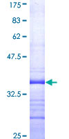 PLA2G2A / SPLA2 Protein - 12.5% SDS-PAGE Stained with Coomassie Blue.