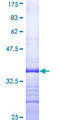 PLA2G2A / SPLA2 Protein - 12.5% SDS-PAGE Stained with Coomassie Blue.