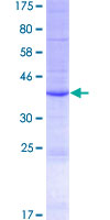PLA2G2E Protein - 12.5% SDS-PAGE of human PLA2G2E stained with Coomassie Blue