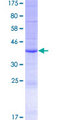 PLA2G2E Protein - 12.5% SDS-PAGE of human PLA2G2E stained with Coomassie Blue