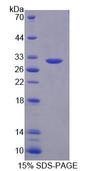 PLA2G3 Protein - Recombinant Phospholipase A2, Group III (PLA2G3) by SDS-PAGE