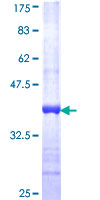 PLA2G3 Protein - 12.5% SDS-PAGE Stained with Coomassie Blue.