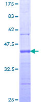 PLA2G4A Protein - 12.5% SDS-PAGE Stained with Coomassie Blue.