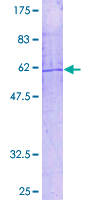 PLA2G4B Protein - 12.5% SDS-PAGE of human PLA2G4B stained with Coomassie Blue