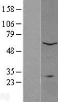 PLA2G4C Protein - Western validation with an anti-DDK antibody * L: Control HEK293 lysate R: Over-expression lysate