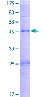 PLA2G4D Protein - 12.5% SDS-PAGE of human PLA2G4D stained with Coomassie Blue