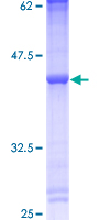 PLA2G5 Protein - 12.5% SDS-PAGE of human PLA2G5 stained with Coomassie Blue