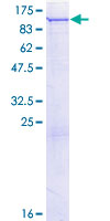 PLA2G6 / IPLA2 Protein - 12.5% SDS-PAGE of human PLA2G6 stained with Coomassie Blue