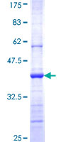 PLA2G6 / IPLA2 Protein - 12.5% SDS-PAGE Stained with Coomassie Blue.
