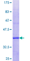 PLA2G6 / IPLA2 Protein - 12.5% SDS-PAGE Stained with Coomassie Blue.