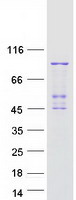 PLA2G6 / IPLA2 Protein - Purified recombinant protein PLA2G6 was analyzed by SDS-PAGE gel and Coomassie Blue Staining