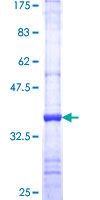 PLAA Protein - 12.5% SDS-PAGE Stained with Coomassie Blue.