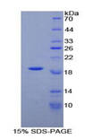 PLAA Protein - Recombinant Phospholipase A2 Activating Protein By SDS-PAGE