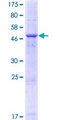 PLAC1 Protein - 12.5% SDS-PAGE of human PLAC1 stained with Coomassie Blue