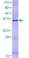 PLAC8L1 Protein - 12.5% SDS-PAGE of human PLAC8L1 stained with Coomassie Blue