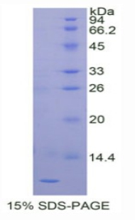 PLAC9 Protein - Recombinant Placenta Specific Protein 9 By SDS-PAGE
