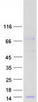 PLAC9 Protein - Purified recombinant protein PLAC9 was analyzed by SDS-PAGE gel and Coomassie Blue Staining