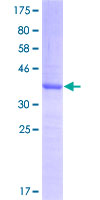PLAG1 Protein - 12.5% SDS-PAGE Stained with Coomassie Blue.