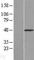 PLAGL1 / ZAC Protein - Western validation with an anti-DDK antibody * L: Control HEK293 lysate R: Over-expression lysate