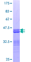 PLAGL1 / ZAC Protein - 12.5% SDS-PAGE Stained with Coomassie Blue.