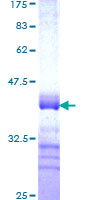 PLAGL2 Protein - 12.5% SDS-PAGE Stained with Coomassie Blue.