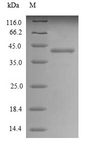 PLAP / Alkaline Phosphatase Protein - (Tris-Glycine gel) Discontinuous SDS-PAGE (reduced) with 5% enrichment gel and 15% separation gel.