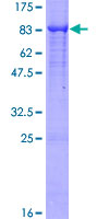 PLAP / Alkaline Phosphatase Protein - 12.5% SDS-PAGE of human ALPP stained with Coomassie Blue