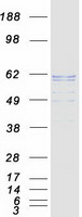 PLAP / Alkaline Phosphatase Protein - Purified recombinant protein ALPP was analyzed by SDS-PAGE gel and Coomassie Blue Staining