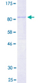 PLAT / TPA Protein - 12.5% SDS-PAGE of human PLAT stained with Coomassie Blue
