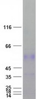 PLAT / TPA Protein - Purified recombinant protein PLAT was analyzed by SDS-PAGE gel and Coomassie Blue Staining