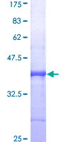 PLAU / Urokinase / uPA Protein - 12.5% SDS-PAGE Stained with Coomassie Blue.