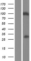 PLB1 Protein - Western validation with an anti-DDK antibody * L: Control HEK293 lysate R: Over-expression lysate