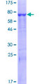 PLB1 Protein - 12.5% SDS-PAGE of human PLB1 stained with Coomassie Blue