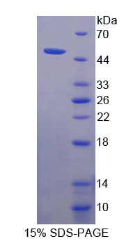 PLB1 Protein - Recombinant Phospholipase B By SDS-PAGE