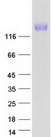 PLB1 Protein - Purified recombinant protein PLB1 was analyzed by SDS-PAGE gel and Coomassie Blue Staining