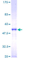 PLBD1 Protein - 12.5% SDS-PAGE of human FLJ22662 stained with Coomassie Blue