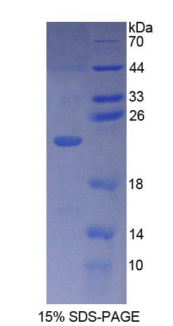 PLCB1 / Phospholipase C Beta 1 Protein - Recombinant  Phospholipase C Beta 1, Phosphoinositide Specific By SDS-PAGE
